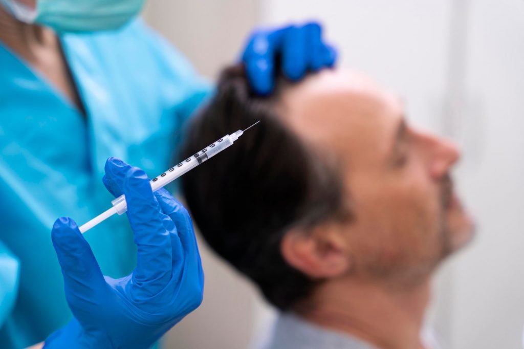 Anesthésie pendant une greffe de cheveux