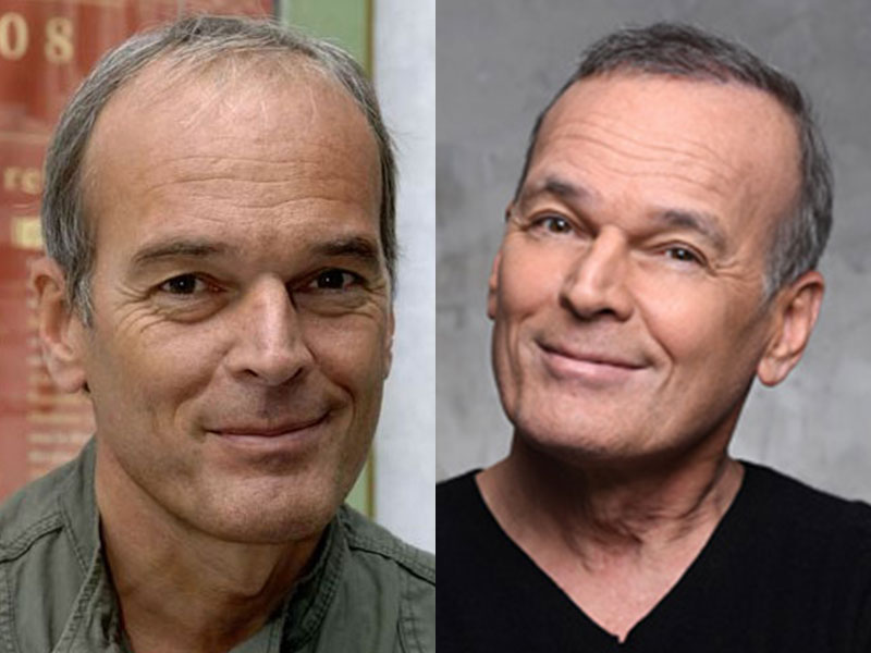 Célébrités françaises avec une greffe de cheveux