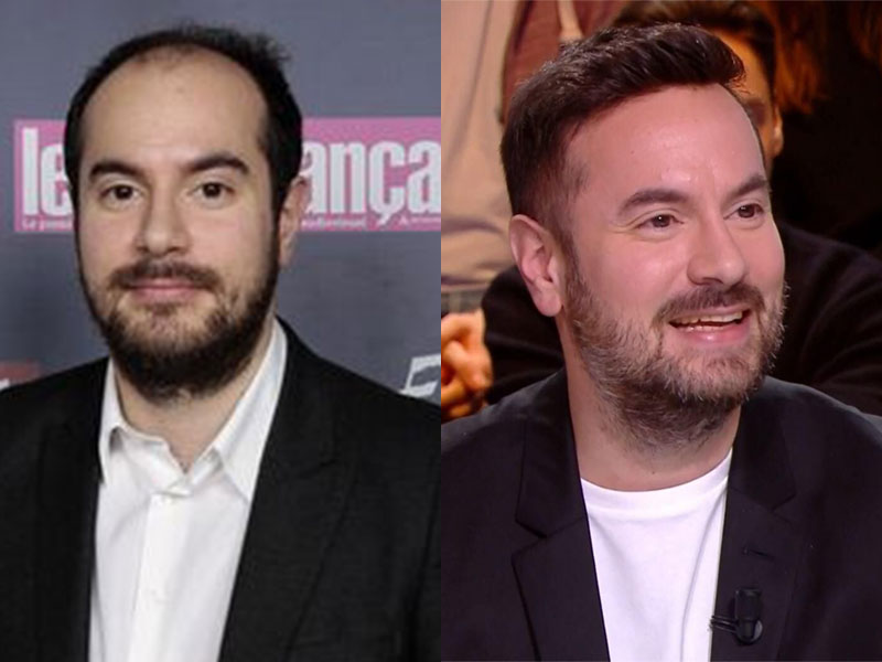 Célébrités françaises avec une greffe de cheveux