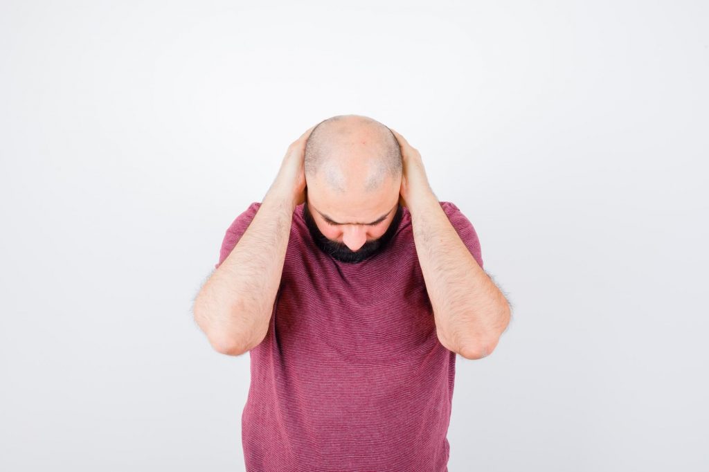 alopécie stress