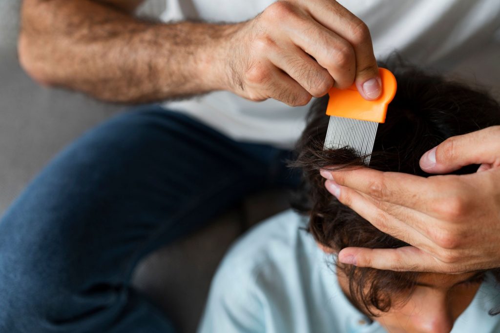 Traitements à domicile alopécie