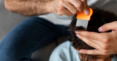 Traitements à domicile alopécie