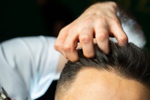 La santé mentale chez les hommes et son impact sur la perte de cheveux