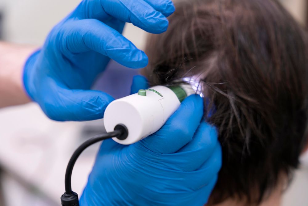 greffes de cheveux infectées