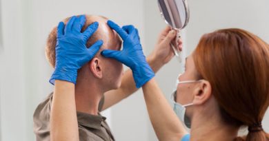 transplantation capillaire