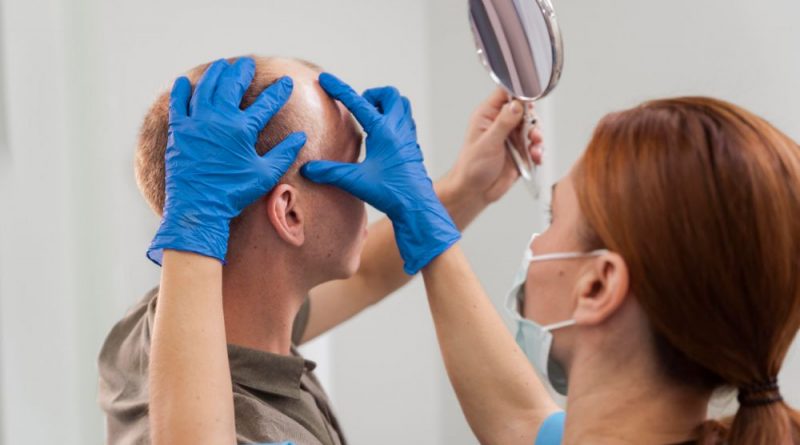 transplantation capillaire