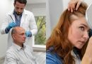 La greffe de cheveux : les différences entre hommes et femmes