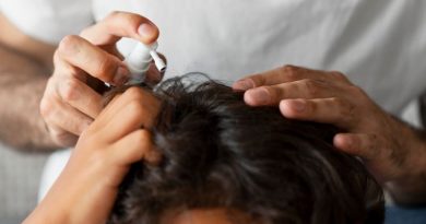 Les meilleurs traitements pour soigner les Pellicules